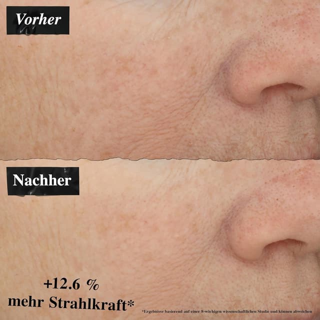 Thumbnail 4 de KIEHL'S Powerful-Strength Line-Reducing Concentrate 12,5% Vitamin C