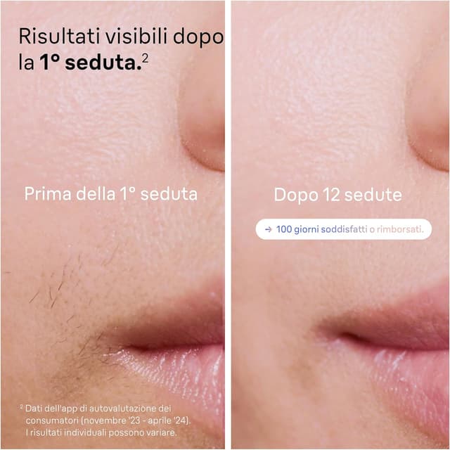 Thumbnail 3 de Braun Skin I·Expert Epilatore Luce Pulsata