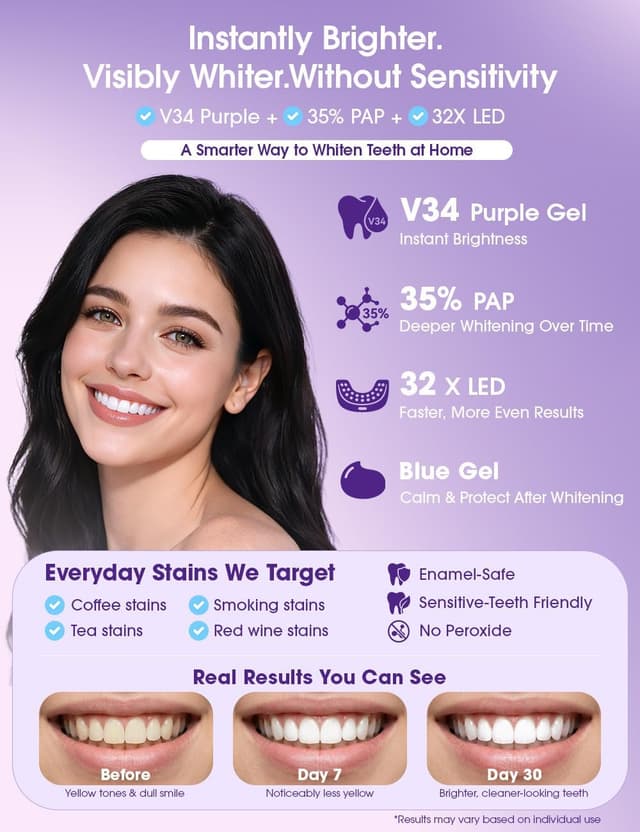 Detalle de Teeth Whitening Kit with LED Light (35% PAP + V34 purple colour corrector) with 3 whitening pens & 2 desensitising gel pens