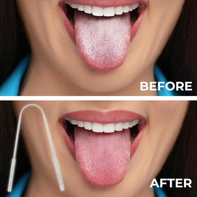 Thumbnail 6 de SS INSTRUMENTX Raschietto per lingua U, 2 pezzi