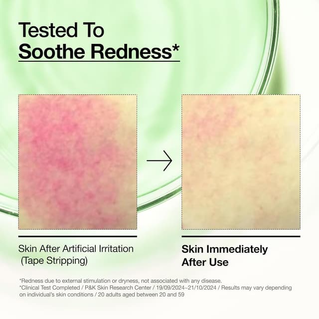 Thumbnail 4 de Anua Azelaic Acid 10 Serum for Redness 30ml