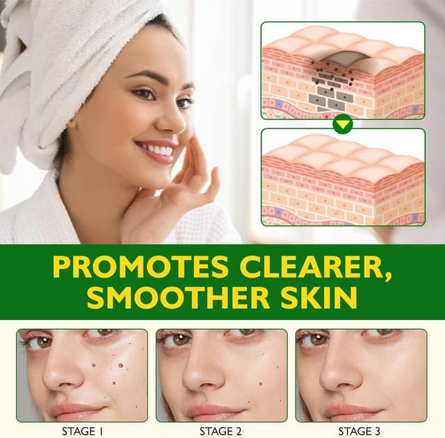 Thumbnail 6 de Bee Venom Cream 120g wart & tag remover