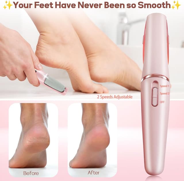 Detalle de ZABOUL Electric Foot Callus Remover (Rechargeable Pedicure Wand) for Dry, Hard Skin