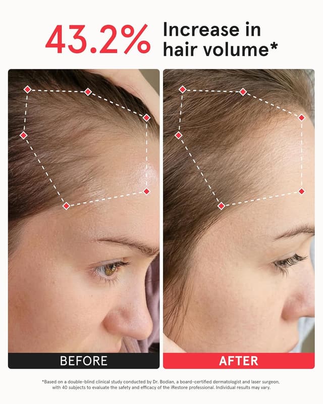 Thumbnail 4 de iRestore Pro Red Light Therapy System