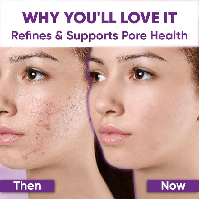 Detalle 2 de AOBBIY Azelaic Acid Cream for Face (1 oz) for redness, uneven tone, and blemish-prone skin