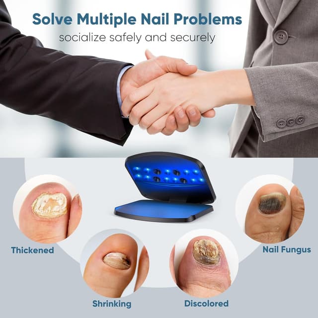 Thumbnail 3 de Nagelpilz Lasergerät 15 LEDs