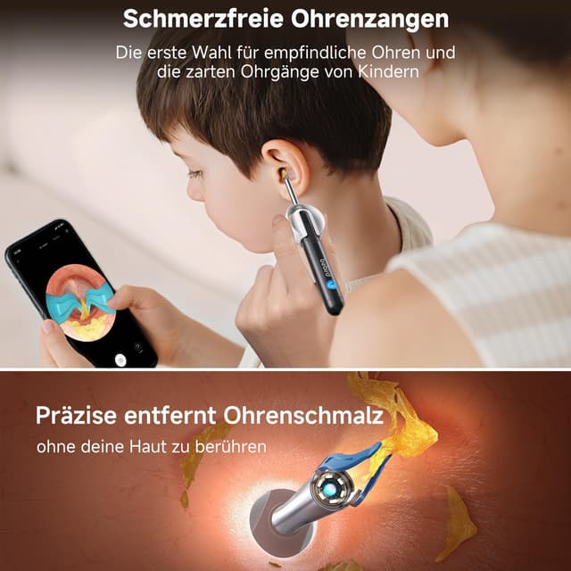 Thumbnail 2 de BEBIRD R1 Ultra Ohrenschmalz-Entferner Otoskop für Zuhause