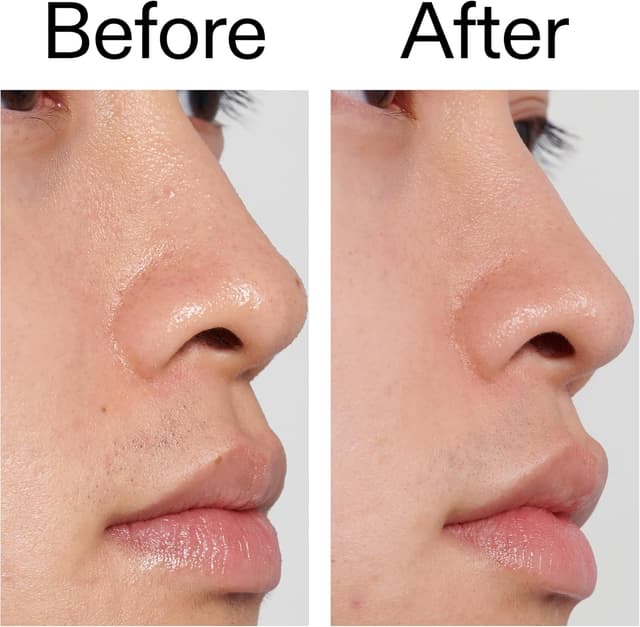 Thumbnail 5 de The Inkey List Peeling all'aceto di mele 30 ml — esfoliante viso