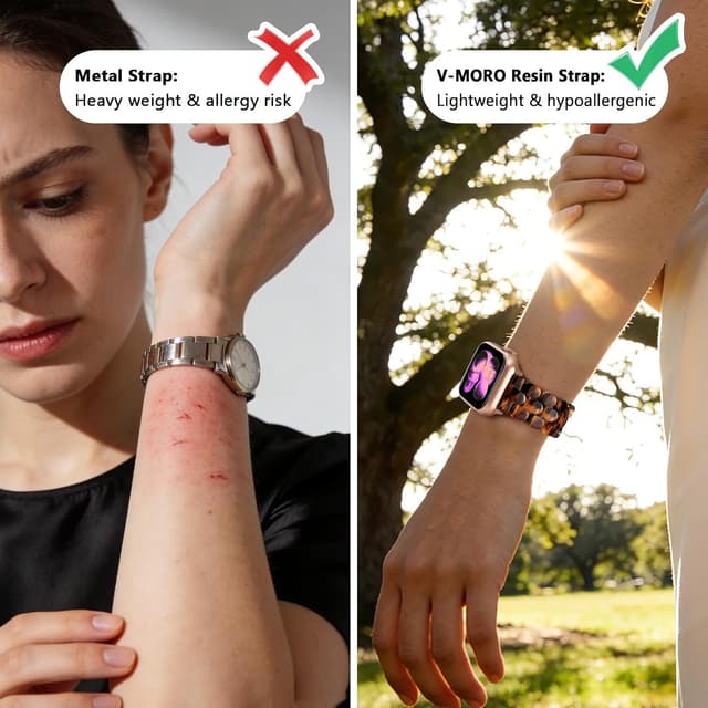 Detalle de V-MORO Amber Tortoiseshell Resin Band for Apple Watch (Series 1–11, 41mm/40mm/38mm/42mm)