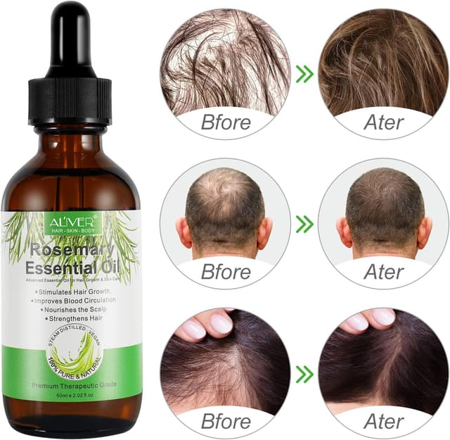 Thumbnail 3 de Huile de Romarin 2 paquets pour cheveux