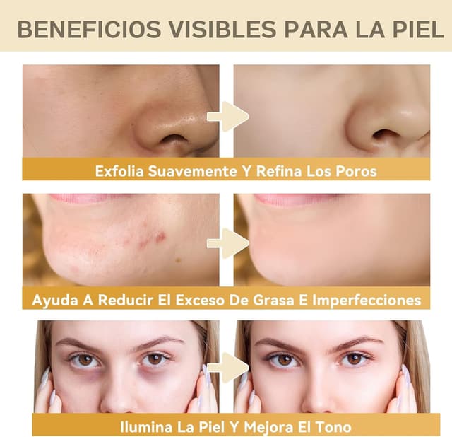 Thumbnail 1 de prowithlin Ácido Glicólico 7% tónico facial