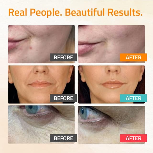 Detalle de Set siero viso YEOUTH 3x30 ml