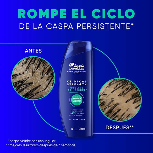 Detalle 1 de Head & Shoulders Cooling Itch Rescue anticaspa