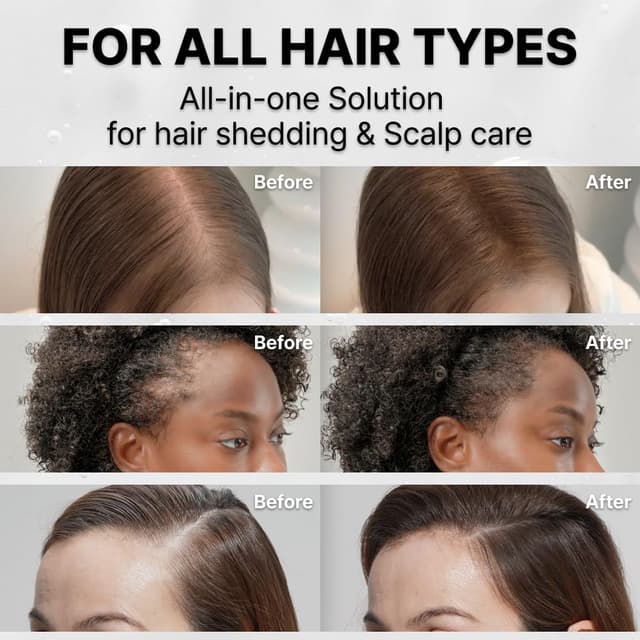 Thumbnail 5 de lilyeve GROWTURN Hair Growth Serum 38