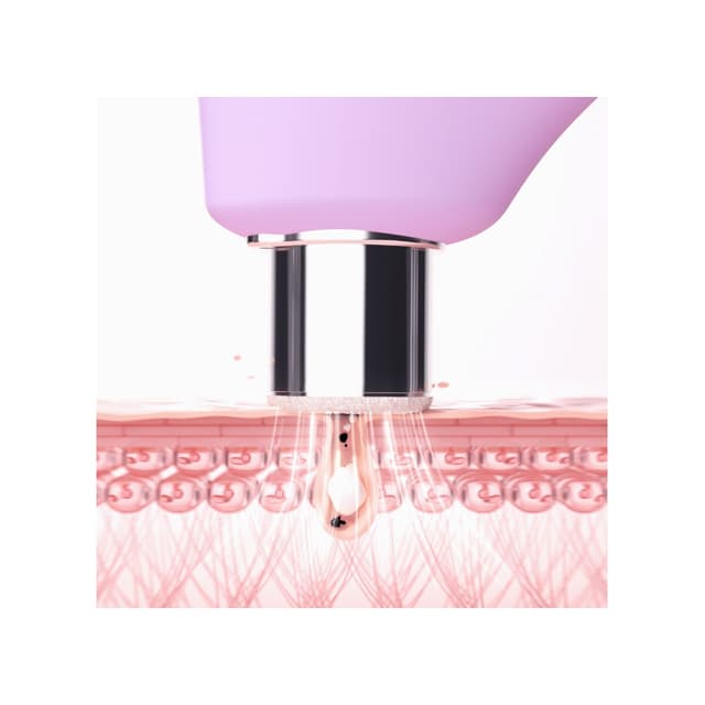 Thumbnail 2 de FOREO KIWI™ derma Microdermoabrasión Adamas y aspiración de poros