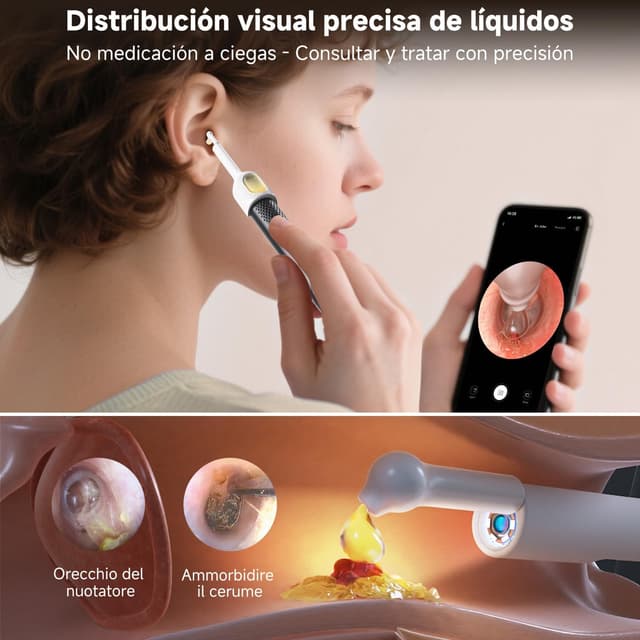 Thumbnail 4 de Bebird R1 Ultra limpiador de oídos con cámara