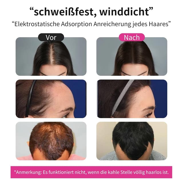 Thumbnail 6 de Sevich Streuhaar 100 g Nachfüllpackung für Haarverdichtung bei ausdünnendem Haar (schwarz)