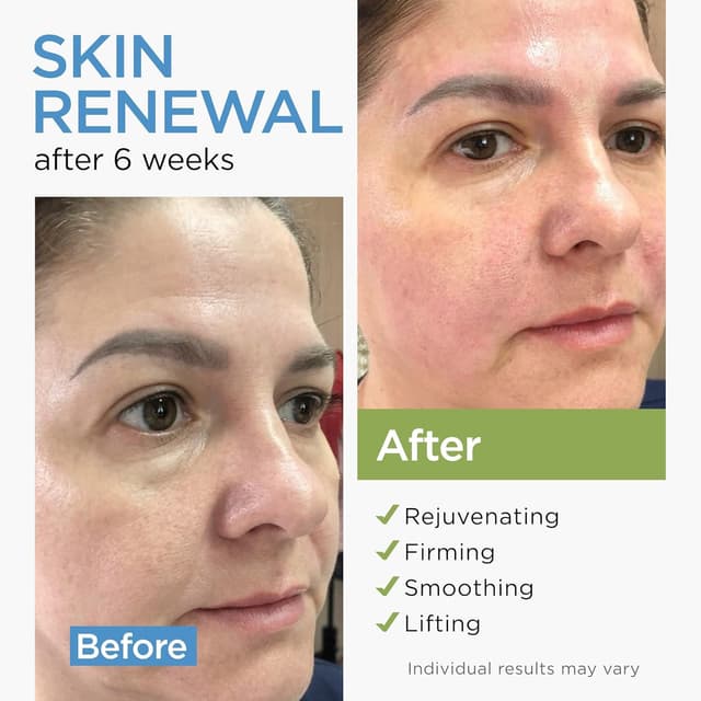 Detalle 2 de Collagen Face Cream with Stem Cells, Retinol, Hyaluronic Acid & Niacinamide (Airless Pump)