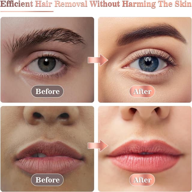 Thumbnail 4 de Vexloria Facial Hair Remover for Women (Face Hair Trimmer) – Rechargeable Lady Shaver for Upper Lip & Peach Fuzz