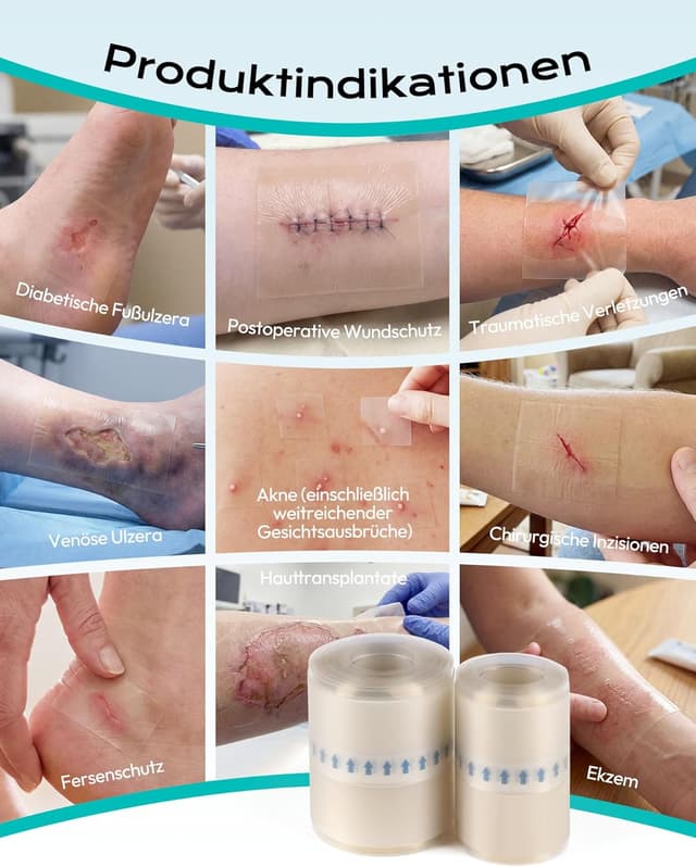 Detalle 2 de daidora Hydrokolloid-Rolle Gesundheitspflaster 5×300 cm (Pickel Patch Rolle) mit Positionierstreifen