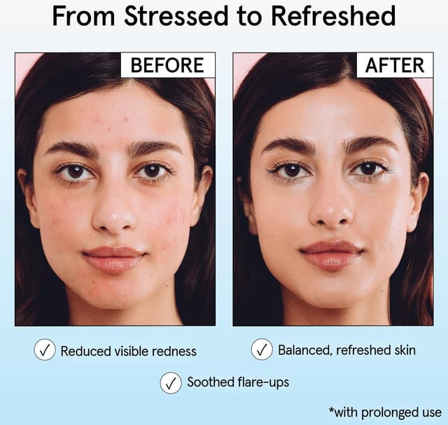 Detalle 2 de grace & stella Hypochlorous Acid Spray for Face (Acne Spray) — Gentle Facial Mist for Redness & Breakouts, 120ml/4 fl oz