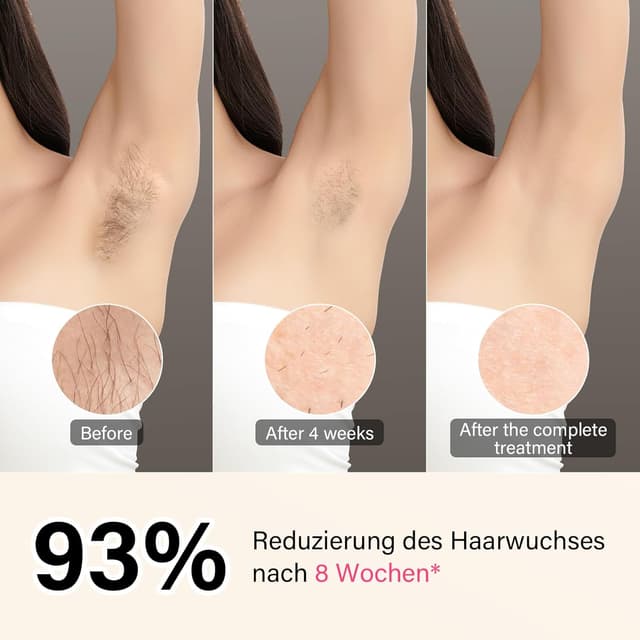 Thumbnail 2 de RWSRW IPL Épilateur lumière pulsée 0,2 s — 5 niveaux 🎀