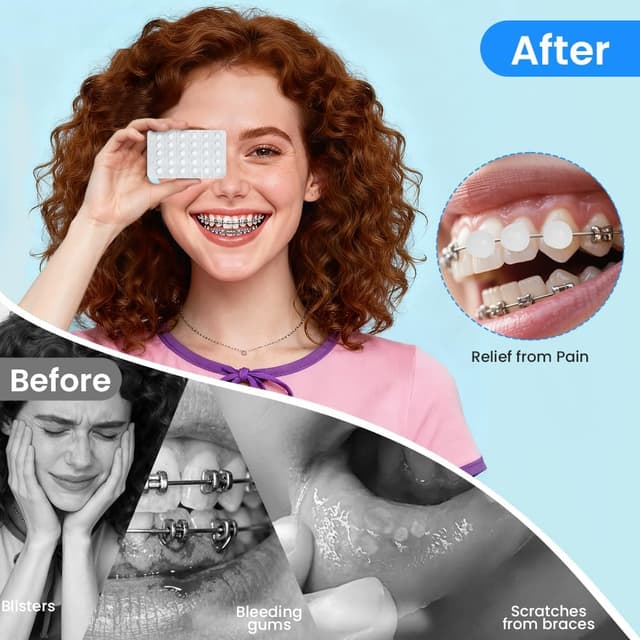 Detalle de AUYAO cera ortodontica in strisce (5 pezzi, gusti misti) per proteggere la bocca e ridurre le abrasioni con apparecchio