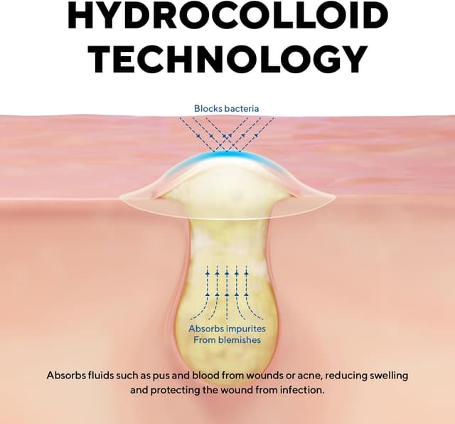 Thumbnail 2 de Caraseoul Parches de Acné con Aloe y Bakuchiol 🌱 (102 U)