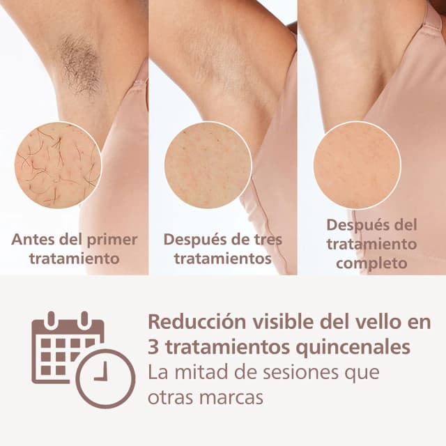 Detalle de Philips Lumea Serie 8000 depiladora IPL 450.000 pulsos