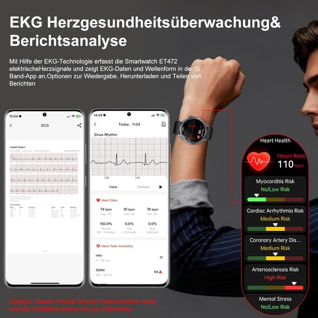 Detalle 2 de YUPENG AI Smartwatch Herren