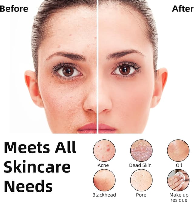 Detalle de Gesichtsreinigungsbürste (Schwarz) – wasserdicht, 360° drehbar, 3 Modi/8 Intensitäten