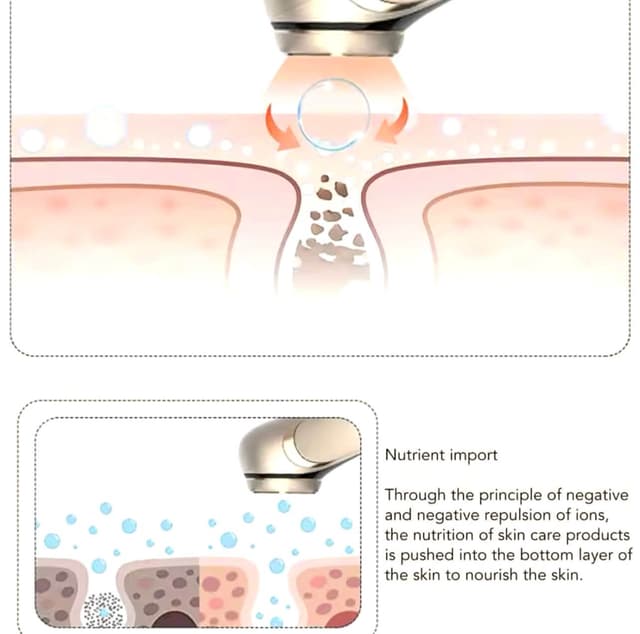 Thumbnail 4 de Drakefor DKF-RF LUXE GOLD radiofrecuencia 2-3 mm