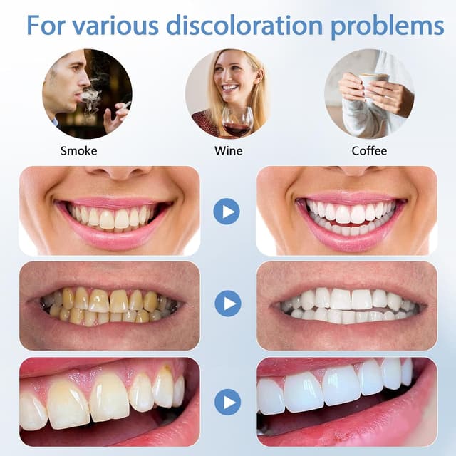 Detalle 2 de ZoCCee Zahnaufhellungsset mit 5 Köpfen