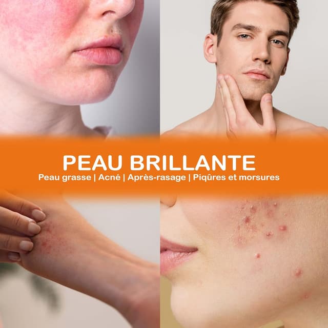 Thumbnail 5 de Lotion tonique visage peau grasse 100 ml