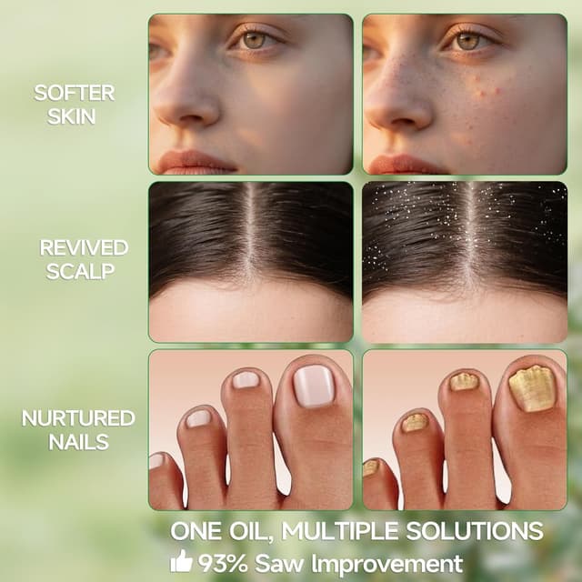 Detalle de PEFIDY Tea Tree Olio Essenziale 118 ml