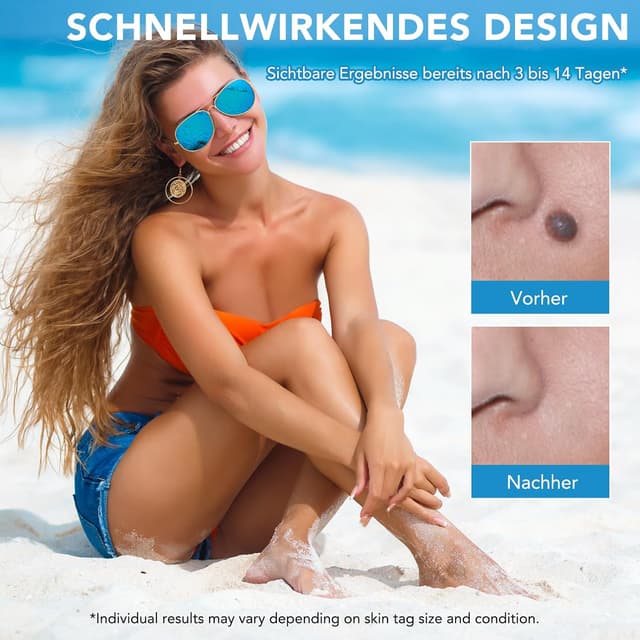 Thumbnail 4 de CFHQXSZ Skin Tag Removal Kit 40 Bands