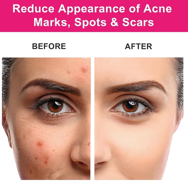 Detalle 2 de MMPANG Rosehip Seed Oil 1 fl oz