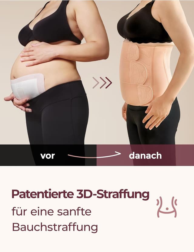 Detalle de Momcozy Ergowrap Bauchgurt nach Geburt – 3D-Kompression & Rückenstütze für die Rückbildung nach Kaiserschnitt (Standard, 2XL)