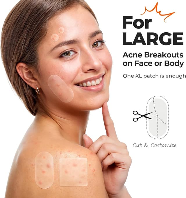 Detalle de TKTK XL hydrocolloid acne patches 124 count