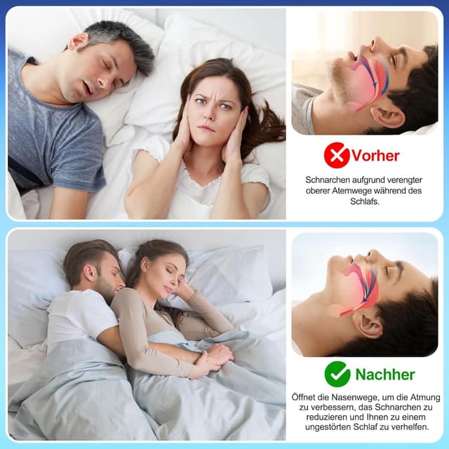 Thumbnail 2 de ZenithHome Nasenpflaster 50er Pack