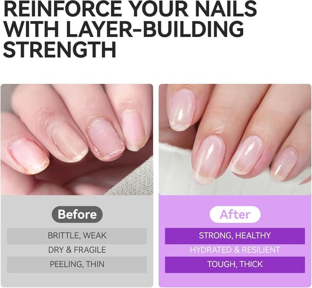 Detalle de Gelike ec Vernis Durcisseur Ongle Fort et Croissance – soin base pour ongles fins et cassés, rose pailleté