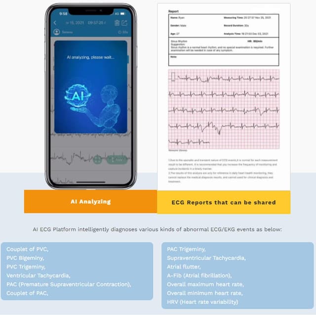 Thumbnail 4 de CheckMe Armfit Plus Blutdruckmessgerät mit EKG und Bluetooth