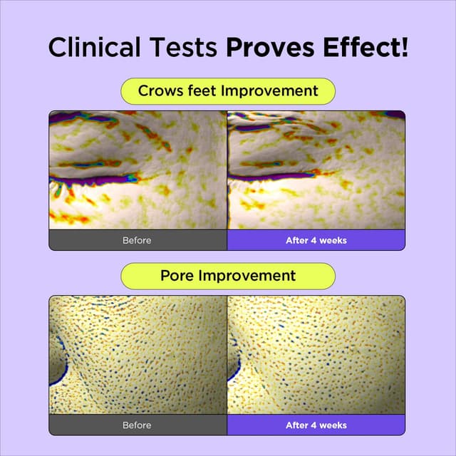Detalle 2 de Vitamin A-mazing Bakuchiol Retinal Nachtcreme 30 g
