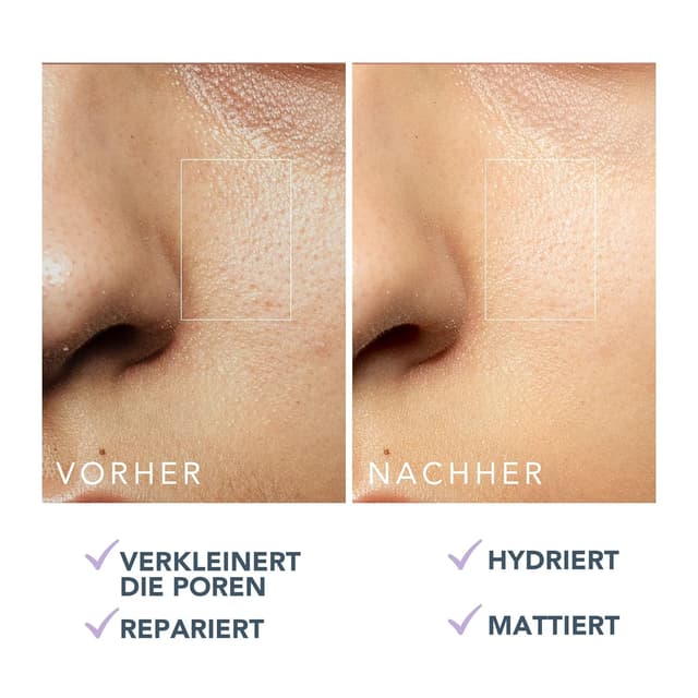 Thumbnail 5 de FOREO KIWI Oil Control mattierende Feuchtigkeitscreme 40 ml