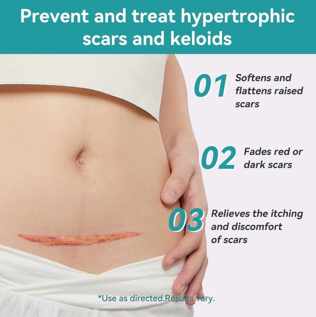 Detalle de Dimora Medical Grade Silicone Scar Sheets (4cm x 3m) for waterproof scar treatment