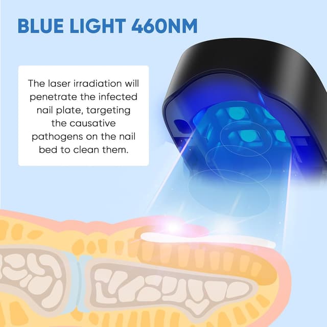 Thumbnail 1 de Berrlly Láser 460nm para Hongos en Uñas 🦶 Fácil y Efectivo