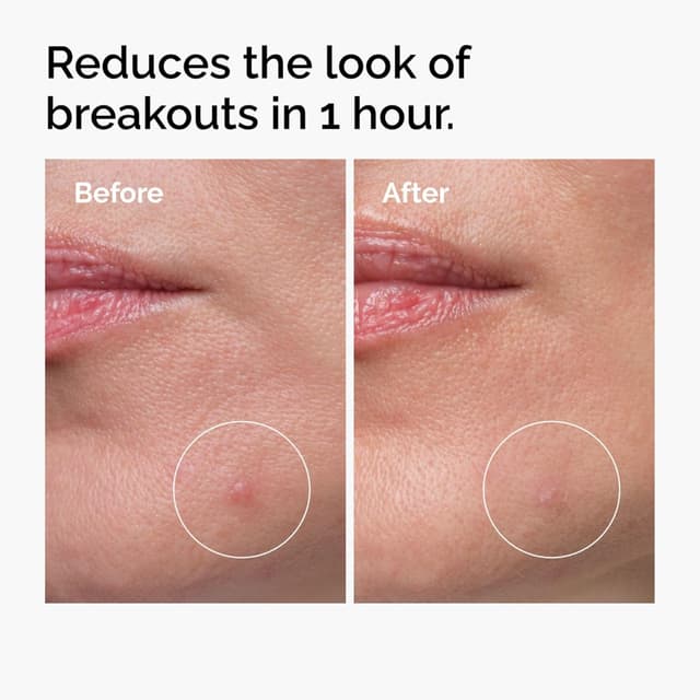 Detalle 2 de The Ordinary Sulfur 10% spot concentrate 5g