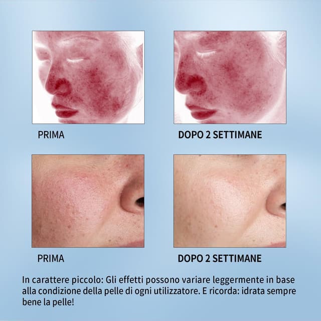 Detalle de RAZUYYEN Maschera viso di riparazione in tessuto (con acido ialuronico, centella e pantenolo) – 10 maschere per pelli secche e sensibili