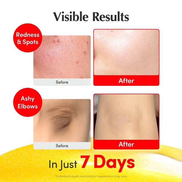 Thumbnail 3 de EQQUALBERRY Vitamin C Brightening Serum 1.01 oz