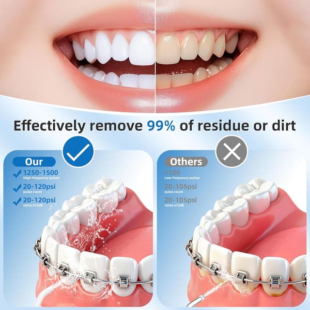 Detalle 2 de Pulsefell Idropulsore dentale portatile ricaricabile 300 ml con 4 modalità e IPX7 (bianco)